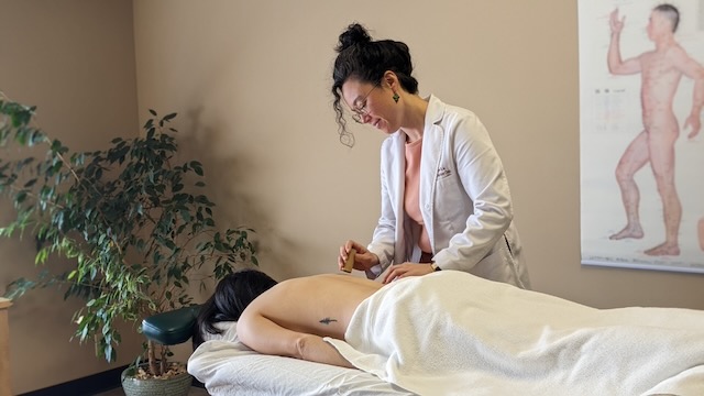 moxa acupuncture levin