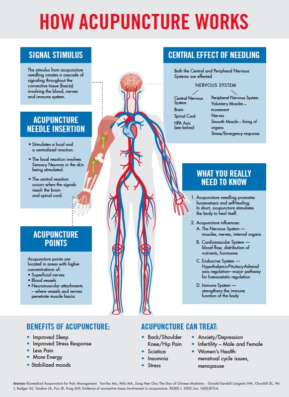 how acupuncture works graphic